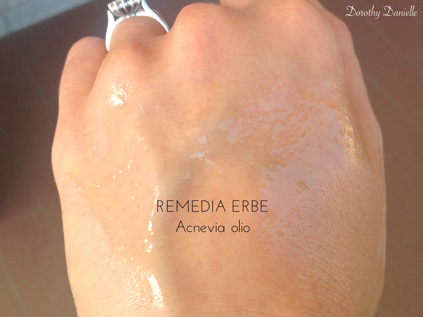 Remedia-erbe-opinione-recensione-acnevia-olio-acne-inci